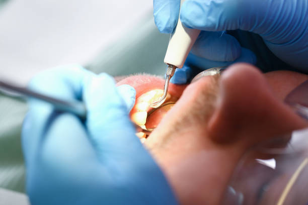 Professional Emergency Dental Service in CA