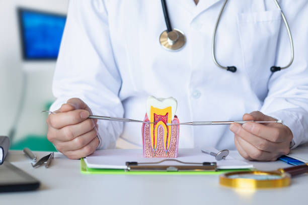 Best Broken or Chipped Tooth Repair in South Pasadena, CA
